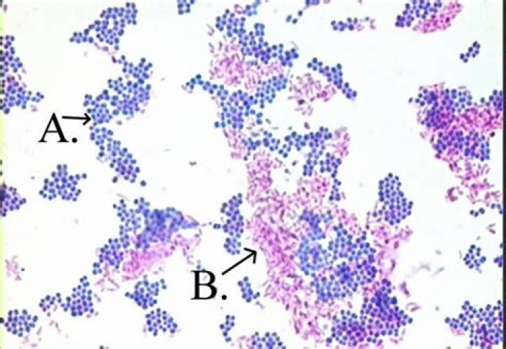 Are acid fast cells stained by carbolfuchsin?