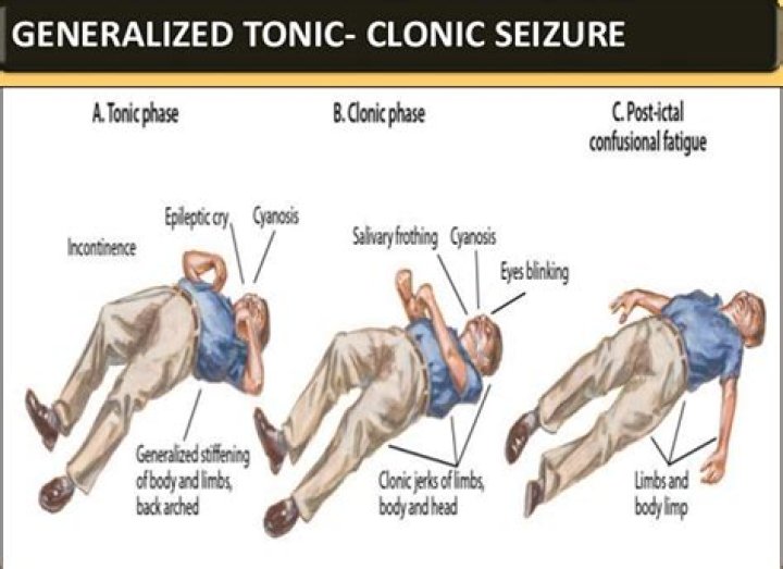 Are convulsions life threatening?