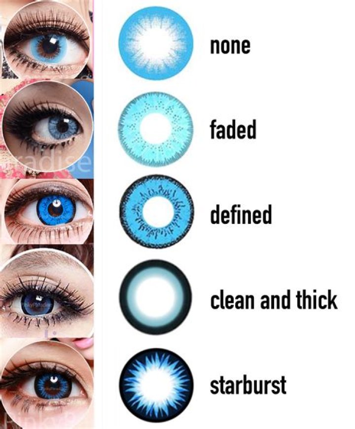 Are limbal rings bad?