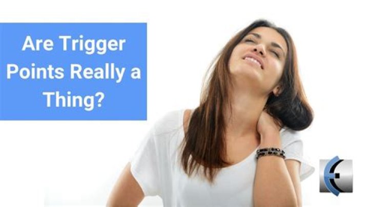 Are trigger points real?