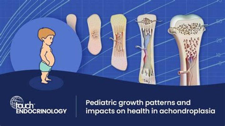 At what age is achondroplasia diagnosed?