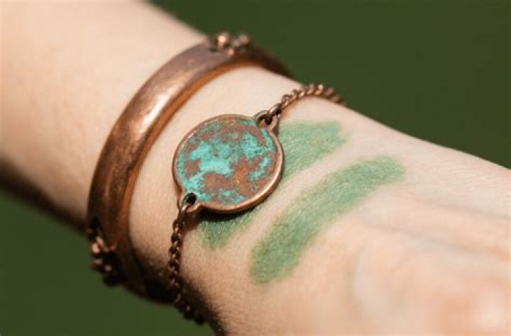 Can 18k gold turn skin green?