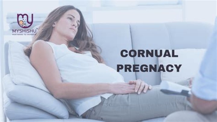 Can a cornual pregnancy move?