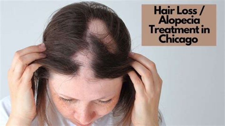 Can alopecia be cured?