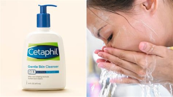 Can cetaphil remove pimples?
