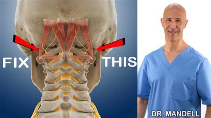 Can having a stiff neck cause dizziness?