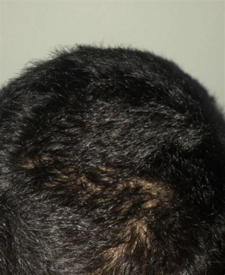 Can pulling hair cause damage?