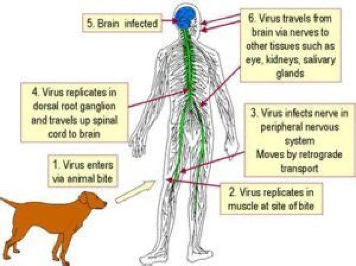 Can rabies transfer from human to human?