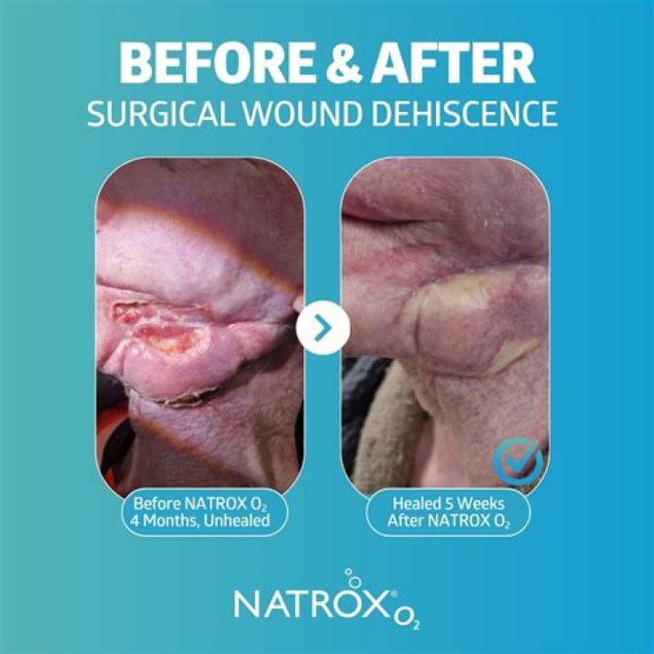 Can wound dehiscence heal on its own?