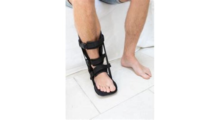 Do night splints work?