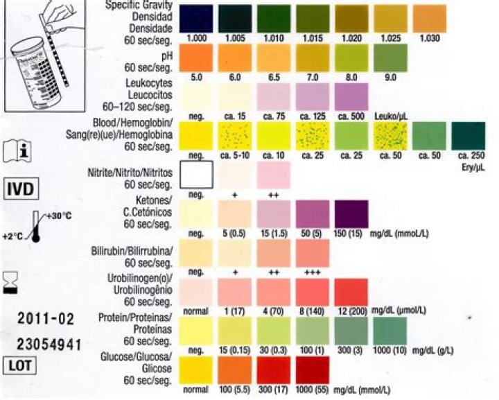 Do urinalysis detect weed?