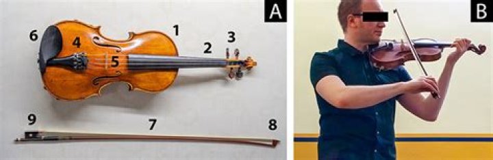 Do violinists have neck problems?
