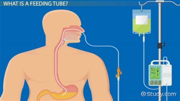 Does a feeding tube hurt a baby?