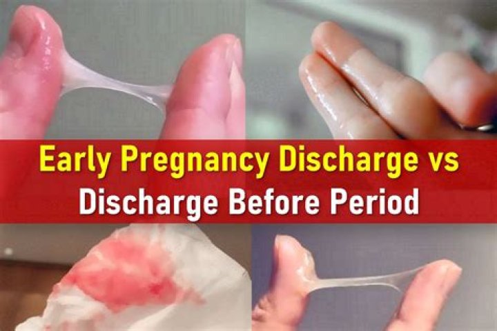 Does discharge change when pregnant?