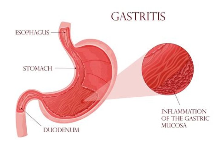 Does gastropathy cause pain?