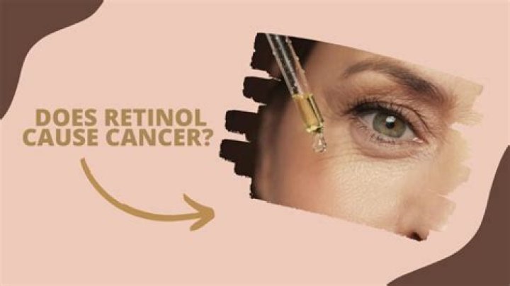 Does retinol cause cancer?