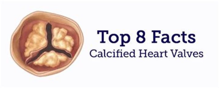 How do heart valves calcify?