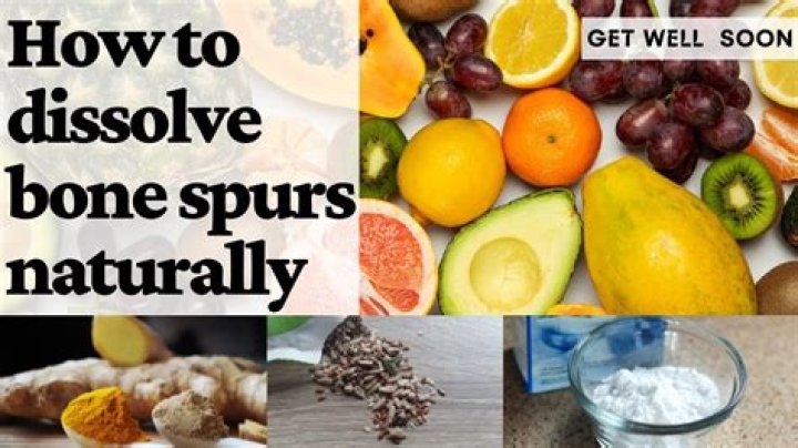 How to dissolve hip bone spurs naturally?