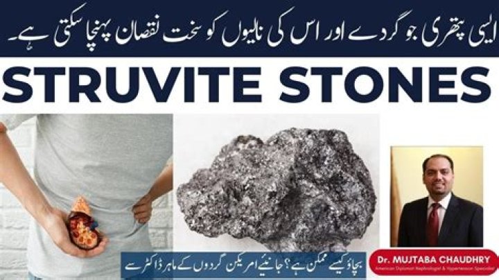 How to dissolve struvite stones in humans?