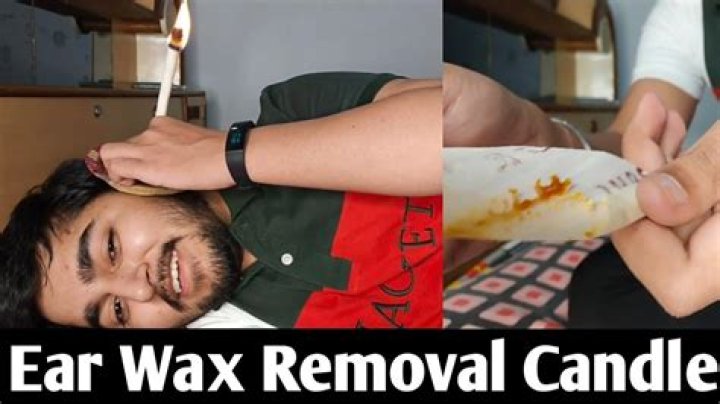 How to earwax candle?