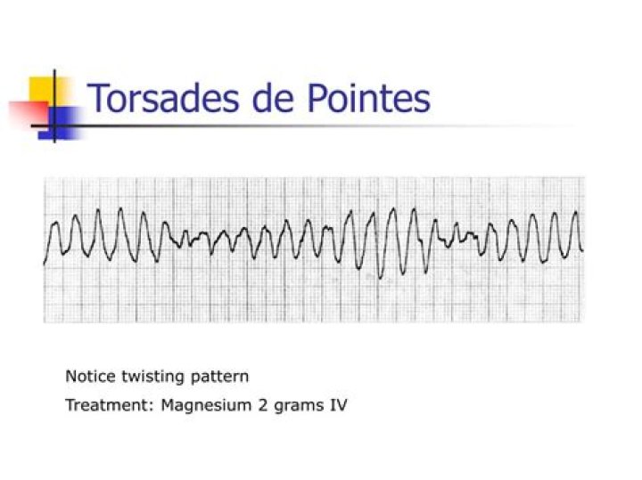 How to treat torsades de pointes?