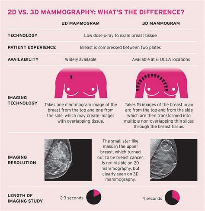 Is 3d mammography a tomosynthesis?