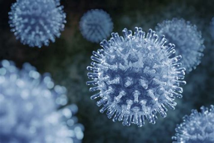 Is viroid a plant virus?