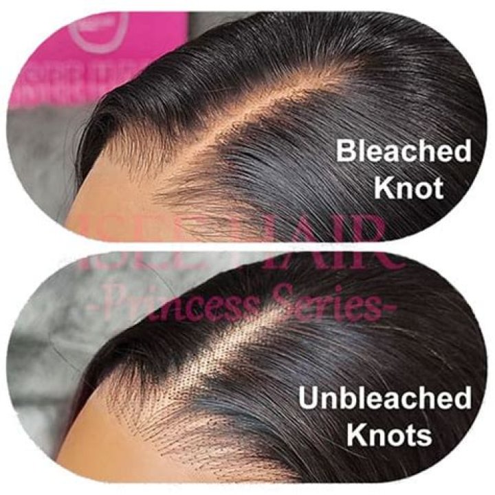 Should i bleach the knots on my lace closure?