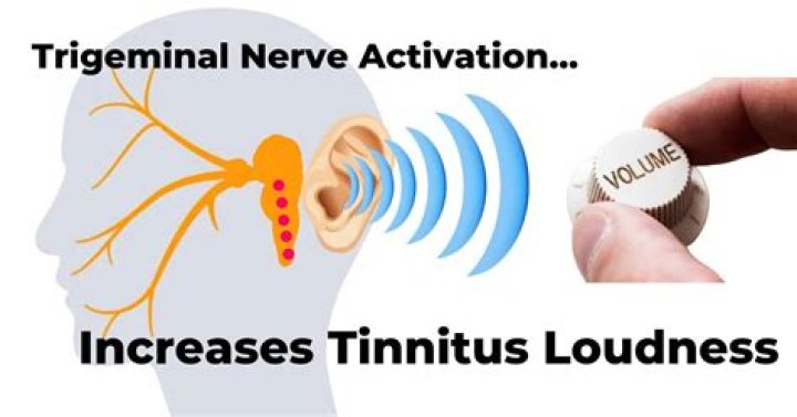 Should tinnitus be investigated?