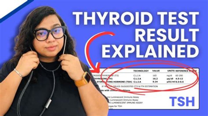 Should tsh be done on empty stomach?