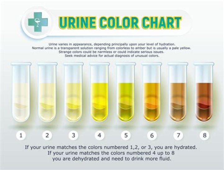 Should urine be totally clear?