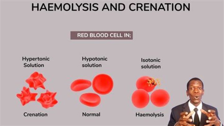 What's crenation and hemolysis?