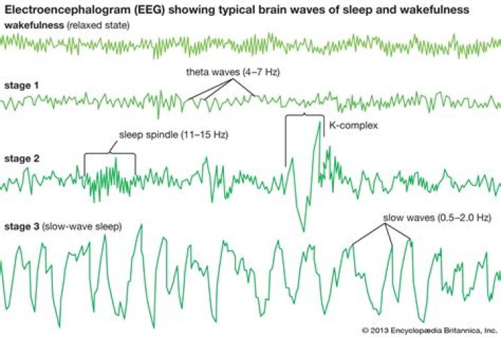 What are electroencephalograms used for?