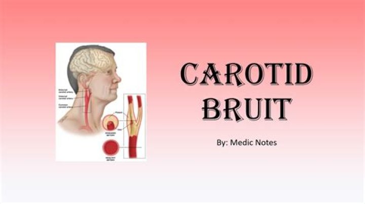 What are symptoms of carotid bruit?