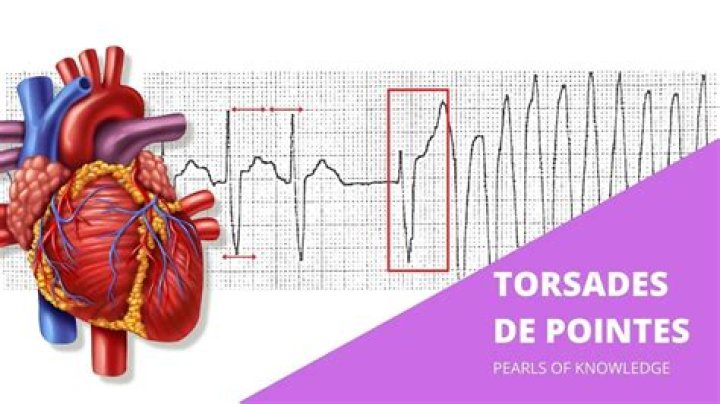 What causes torsade de pointes?