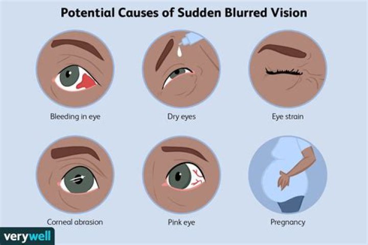 What does it mean to get bleary-eyed?