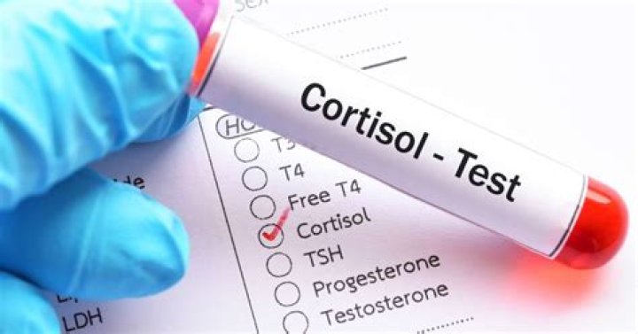 What is a cortisol test?