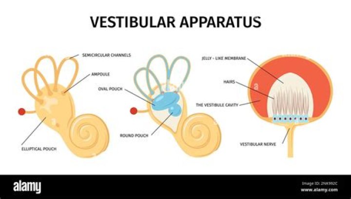 What is a vestibular episode?