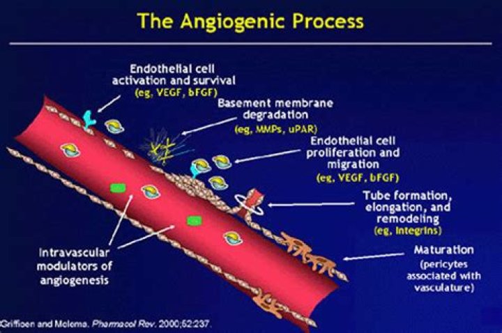 What is angiogenesis in cancer?