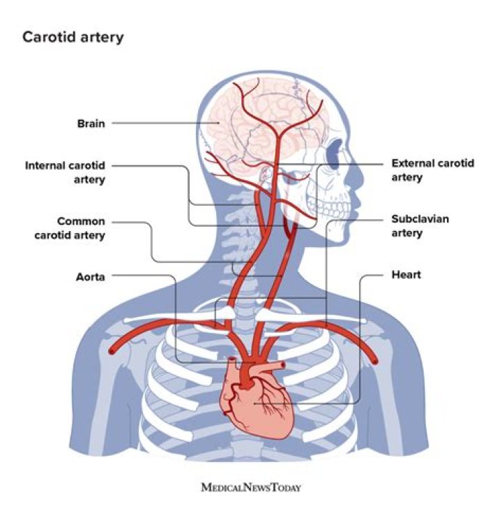 What is carotid artery?