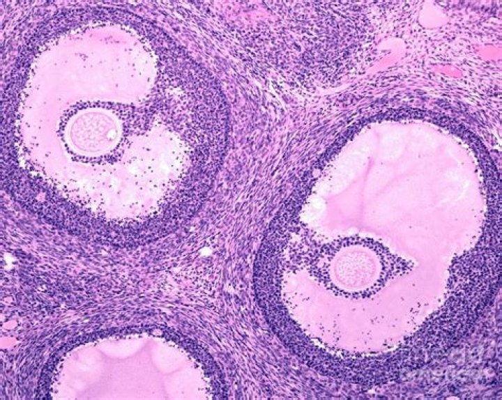 What is follicular atresia?