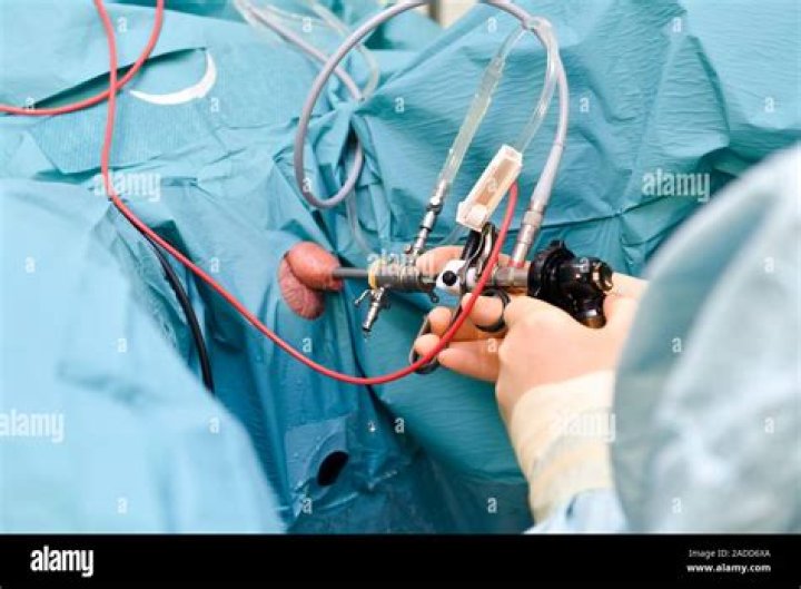 What is transurethral electrosurgical resection of prostate?