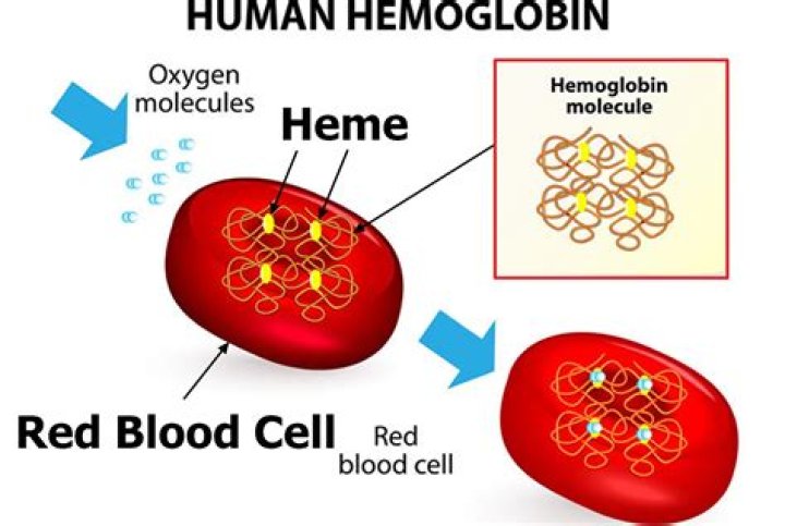 Where can methemoglobinemia be found?