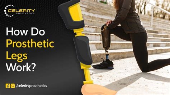 Where do prosthetics work?