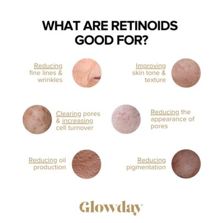 Where do retinoids come from?