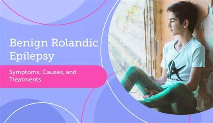 Who treats benign rolandic epilepsy?