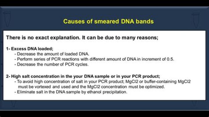Why dna ladder smeared?