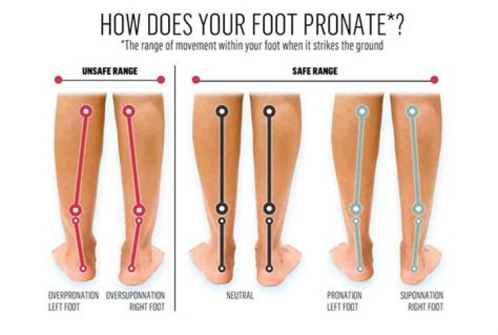 Why do i walk inwards?