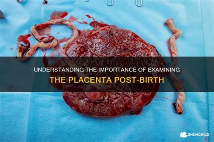 Why examine the placenta?