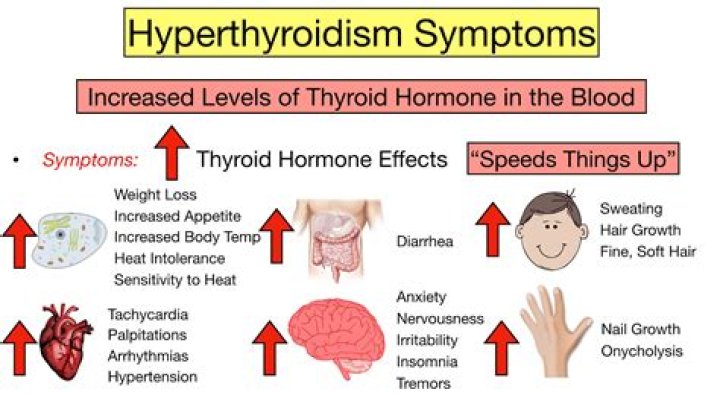 Why is my tsh high?